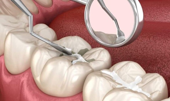Preventive Dentistry