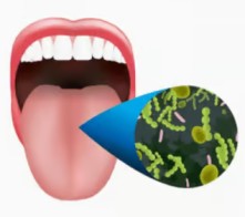 Bad Breath Treatment
